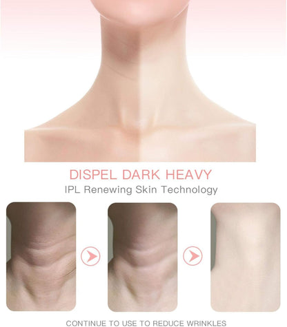 Beauty Massage Instrument Ems Thermal Neck Facial Lifting Face Skin Tighten Electric Micro-Current Wrinkle Remover Tools A