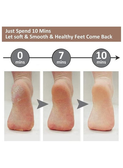 Professional Electric Callus Remover & Foot File - Rechargeable Pedicure Tool with LED Light